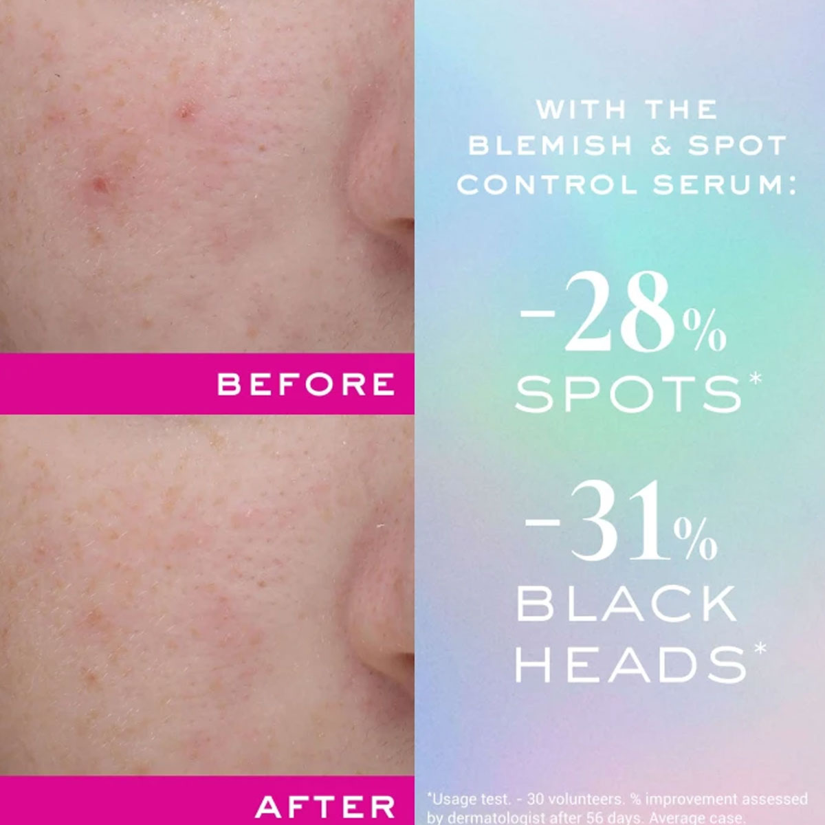 NUXE Zinc Power Blemish and Spot Control Serum
