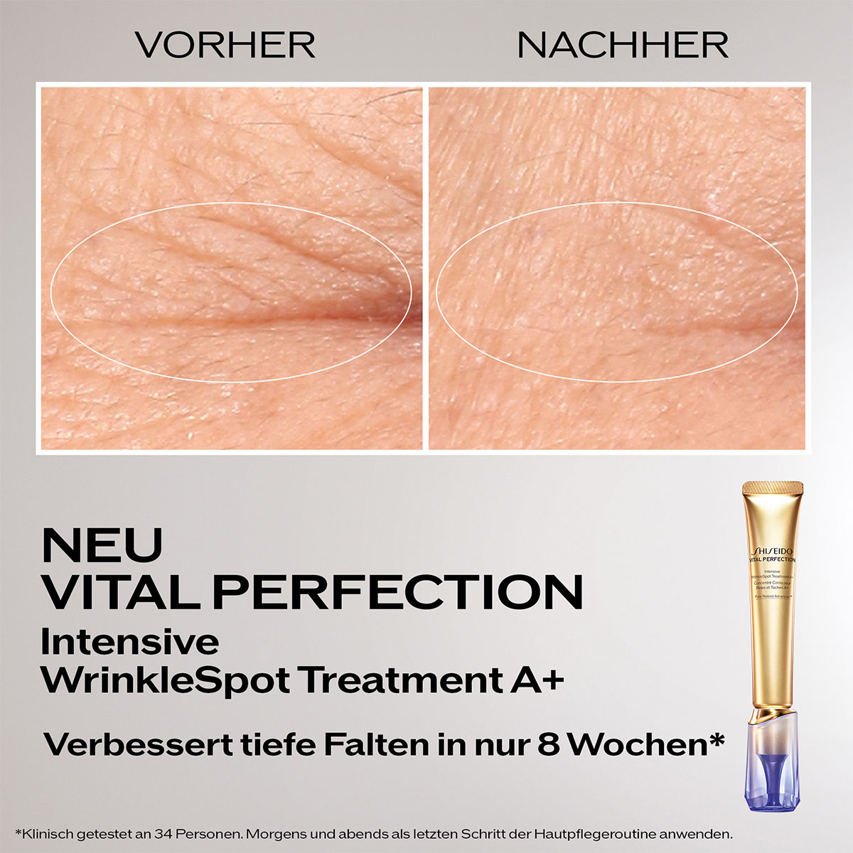 Shiseido Vital Perfection Intensive WrinkleSpot Treatment A+