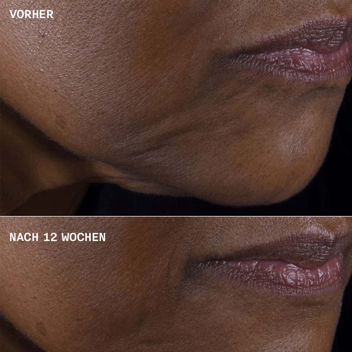 Clinique Smart Clinical Repair Lifting Face + Neck Cream