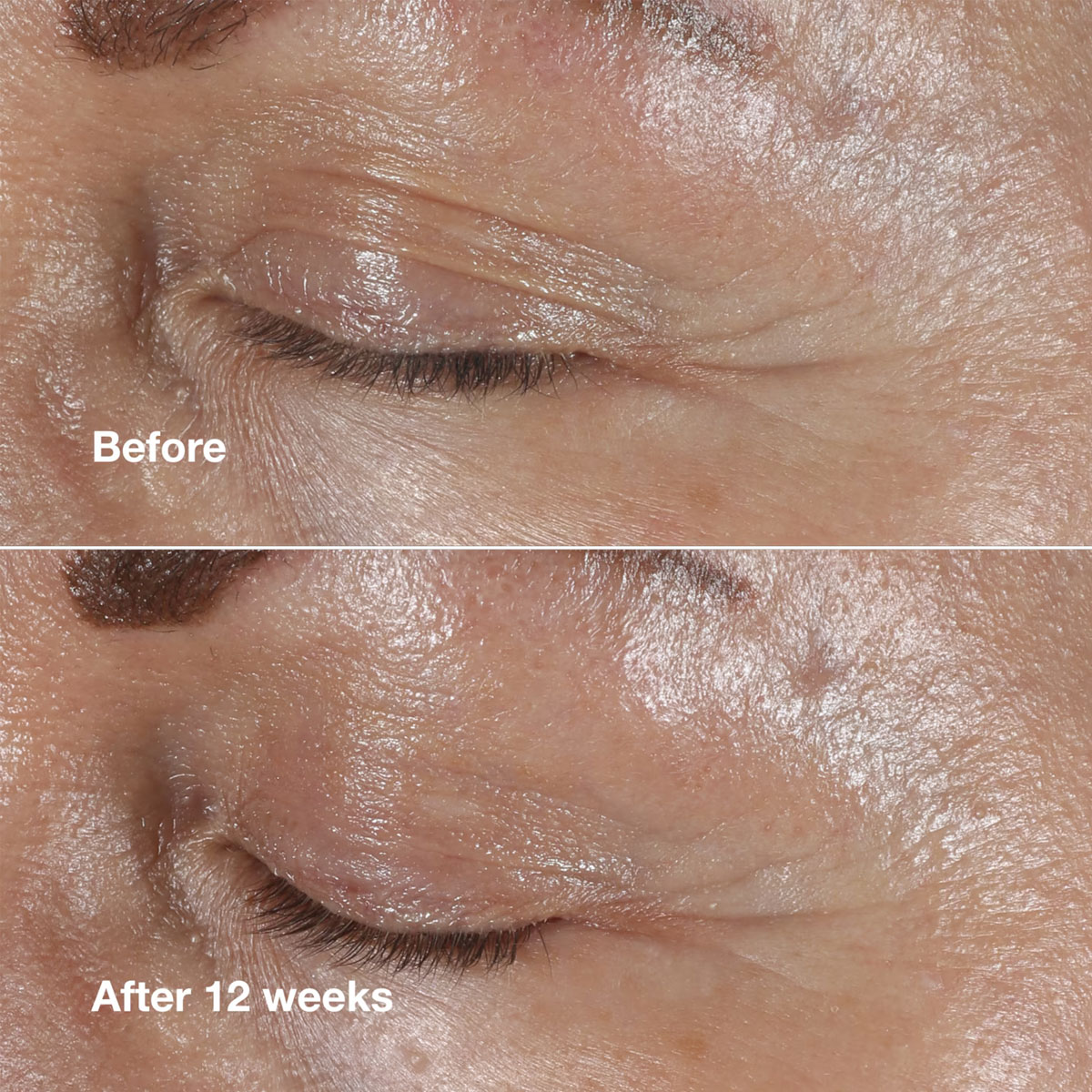 Clinique Smart Clinical Repair Wrinkle Correction Eye Cream